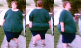Manders 6 months after surgery