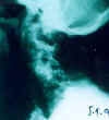 kr_98a.jpg (8962 bytes)