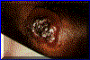 antrazl.gif (83066 bytes)