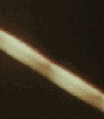 Close up of the cord anomaly.