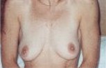 44, S�lo de d�a todos los d�as