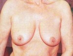 63, nunca salvo casos puntuales