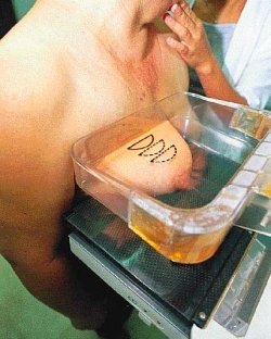 Si bien la mamograf�a puede ser molesta y algo dolorosa, sigue siendo el mejor m�todo de prevenci�n y diagn�stico precoz contra el c�ncer de mama.
