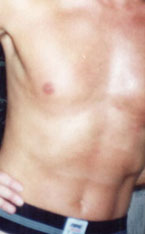 massage relax stress relief miami