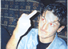 John reduced to one finger