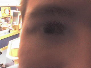 Matt's eye!