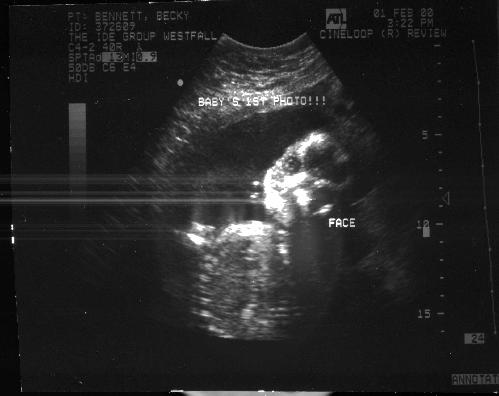 Lilbb U/S 25wks - 21 KB