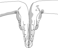 carpal tunnel&nbsp;2