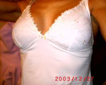 RE-DO, 9 days post, clothed.