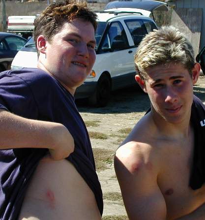 War wounds