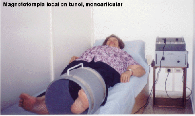 magnetoterapia