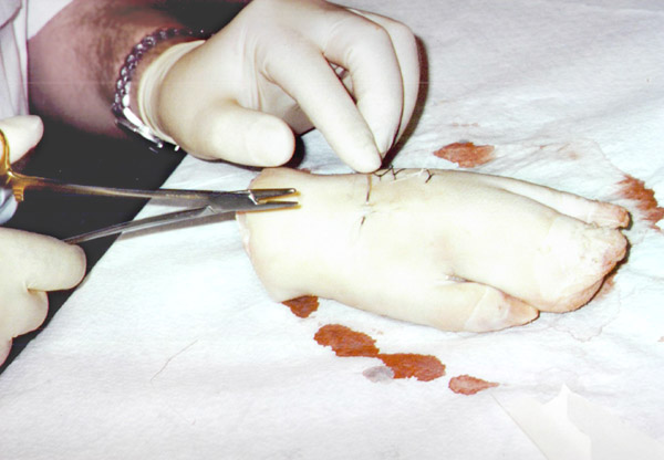 stitches 4