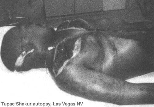 tupac-autopsy1.jpg (26798 bytes)
