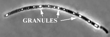 UnknownMicrobe.gif (32607 bytes)