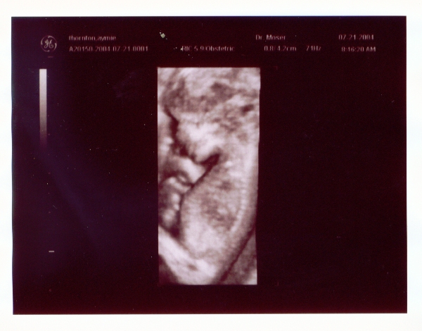 Click on picture to return to sonogram pictures