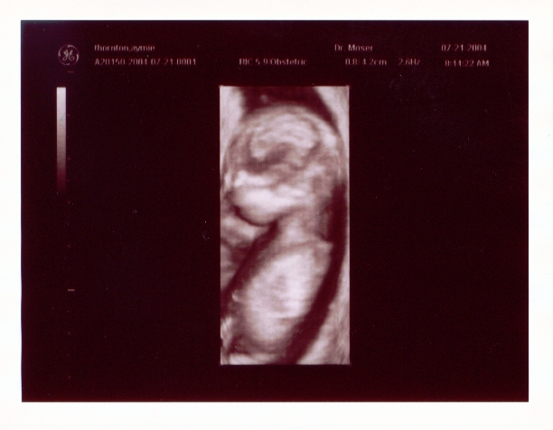 Click on picture to return to sonogram pictures
