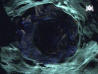 To to the Chasm Picture page