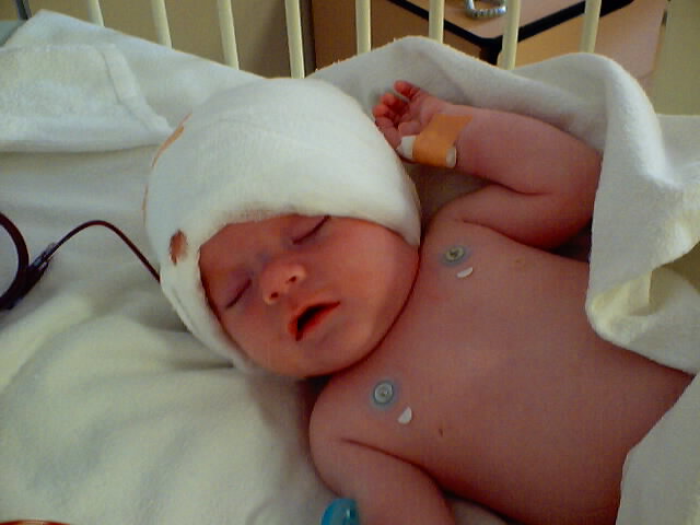 Only hours after surgery