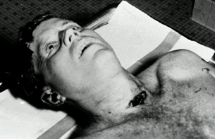 Autopsy photo