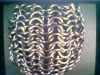 hackysack thumbnail