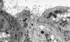 Particles bursting the cell wall