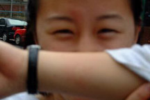jaime proudly showing her mosquito bites~