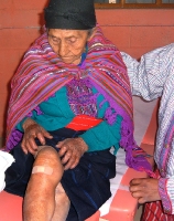 paciente-se-inspecciona-la-rodilla-Todos-Santos-Cuchumatan