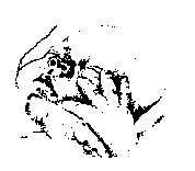 The Anencephaly Support Foundation