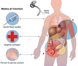 ebola body