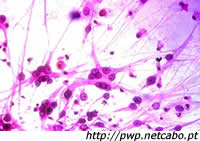 roxo