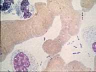 Yersinia pestis - click for larger image
