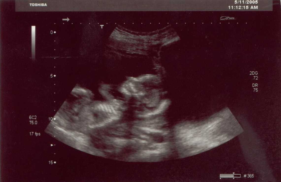 Hey! There is not a lot of womb in here.