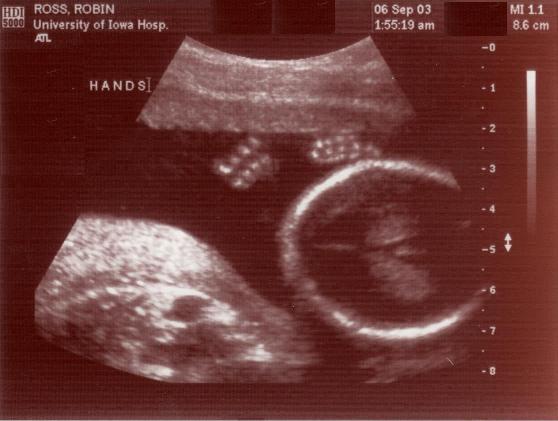 I got my dukes up!