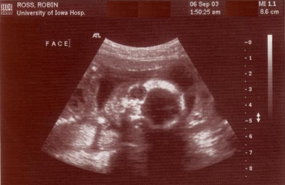 This is me in the womb!