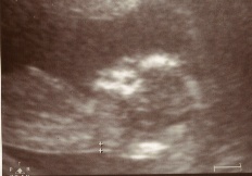 13-weeks