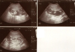 16-weeks