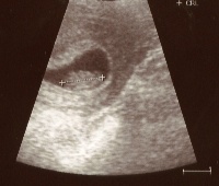 8-weeks