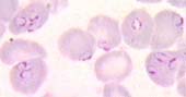 malaria in Thailand