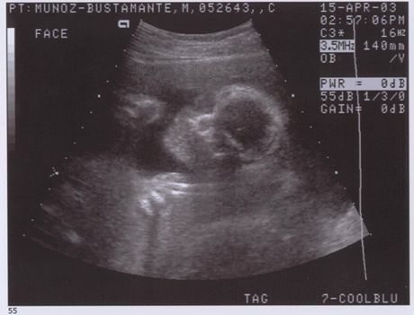 It's Boo at 23 weeks on the dot!