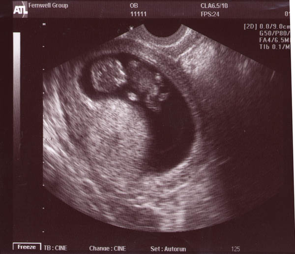 Boo at 10 weeks