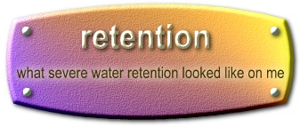 What severe Water looks like