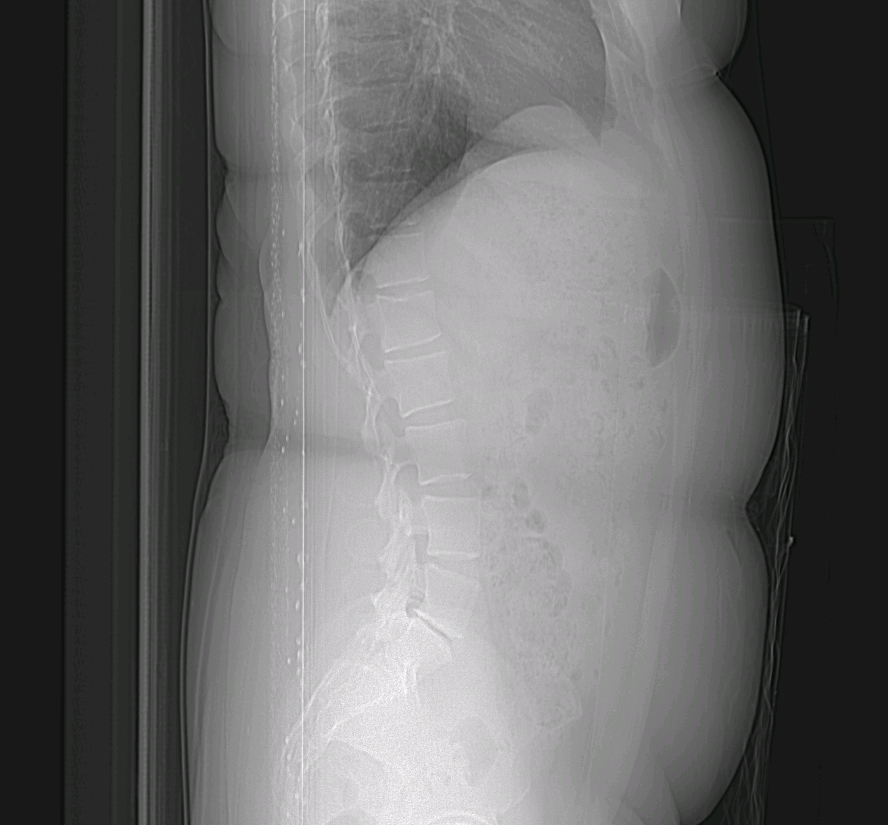 This is from a Cat Scan nov 23, 2007 