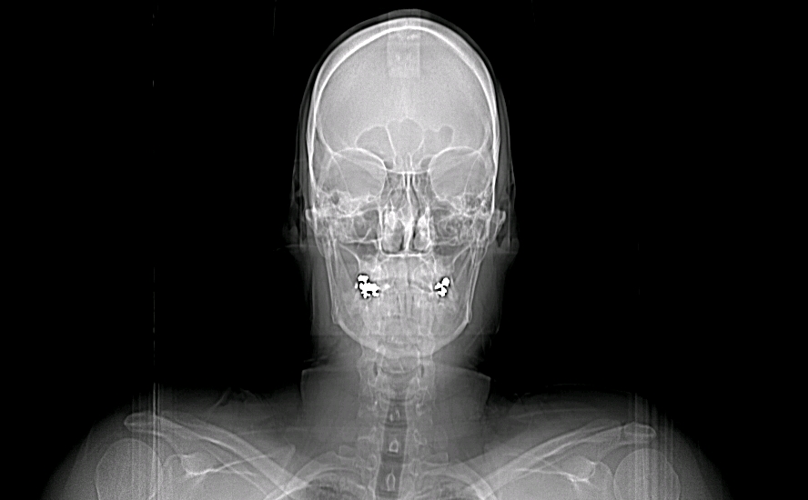 this is my frontal view of my head