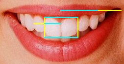 human teeth