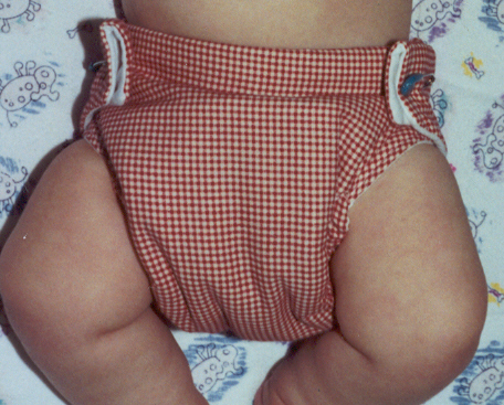 Medium setting on a 15 pound baby