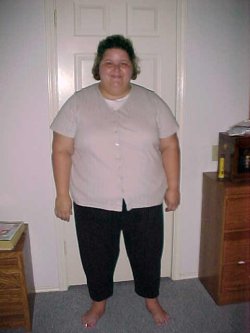 Denise C before