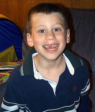 Jeffrey with teeth
