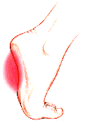 Arch