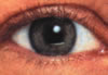 Eyebrows before