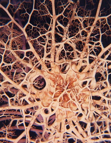 Basket Star